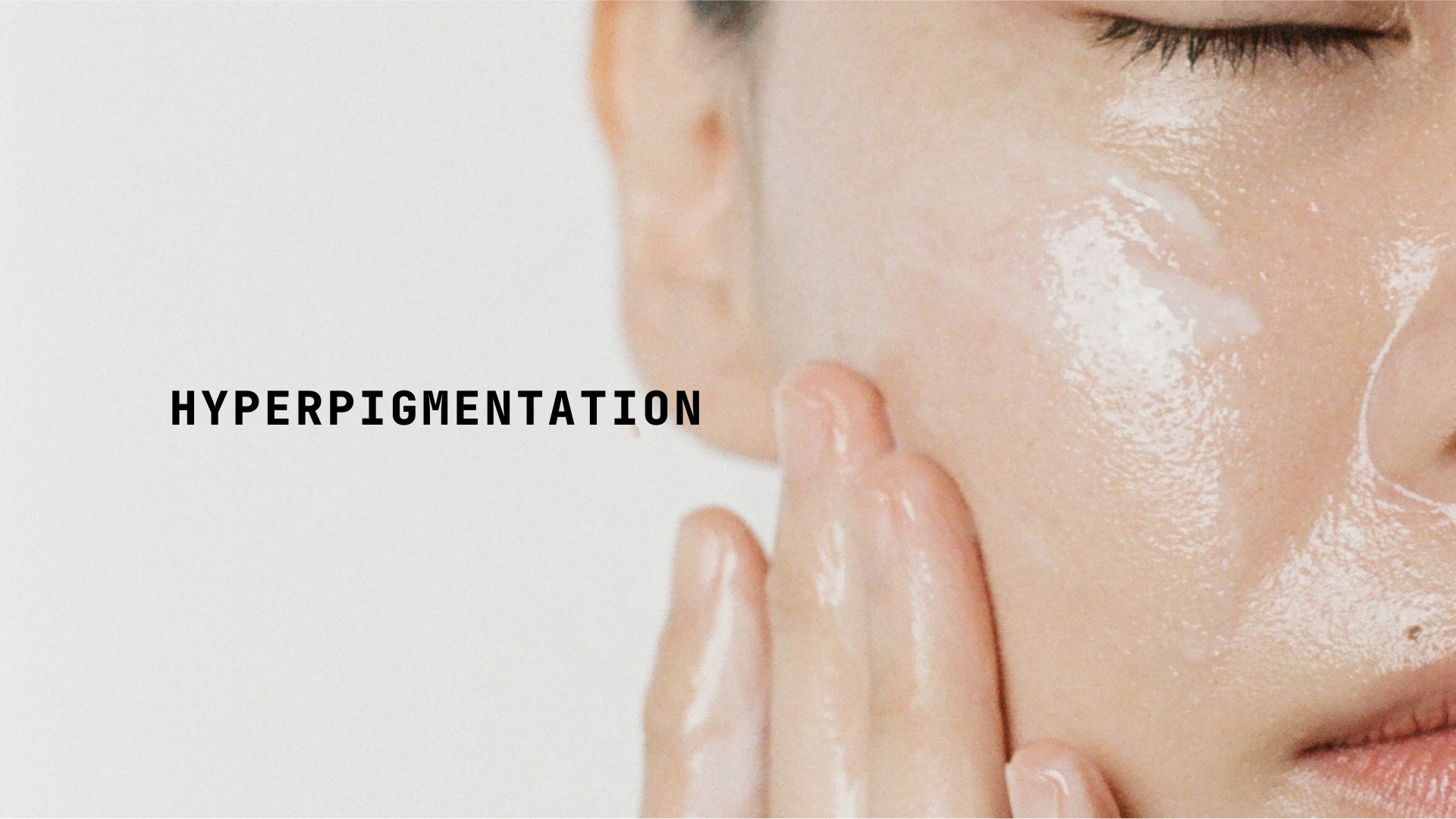 Hyperpigmentation - TYPEYOURSKIN