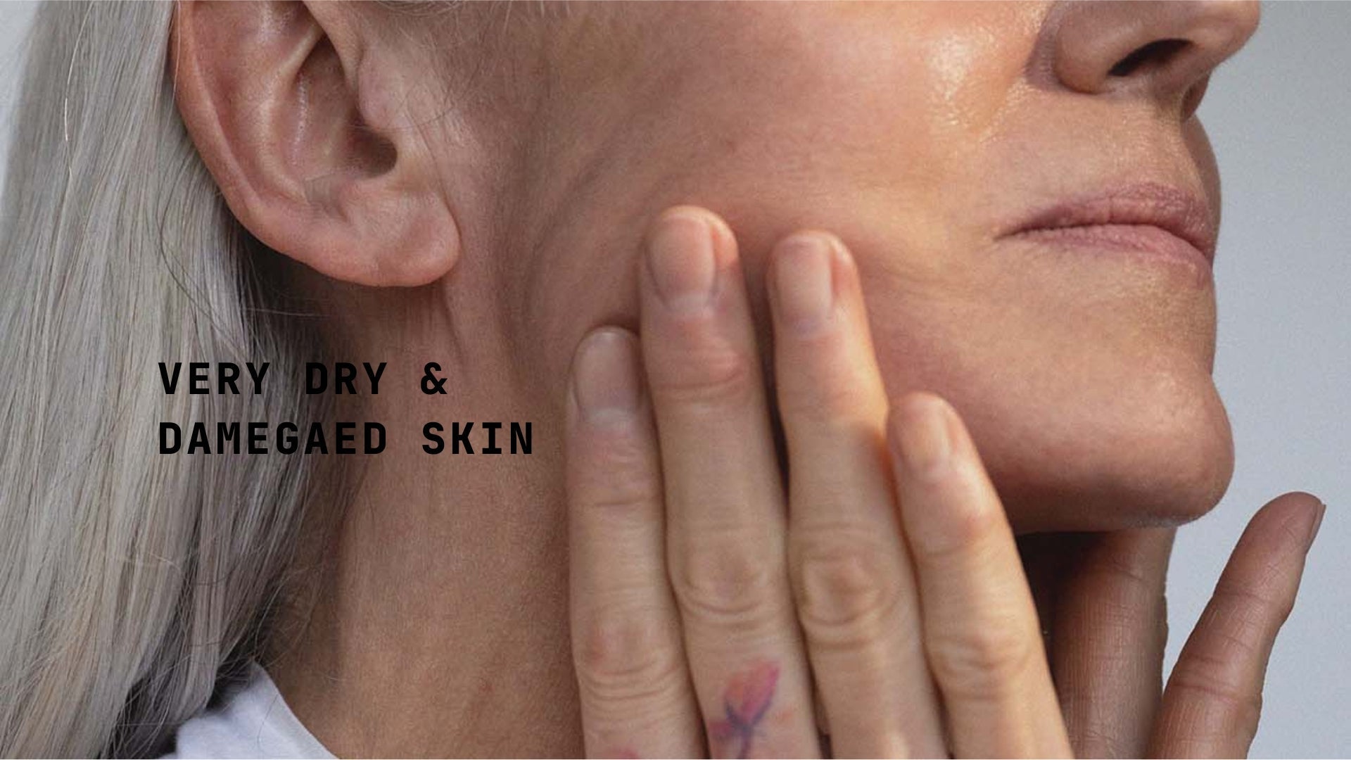 Very Dry & Damage skin - TYPEYOURSKIN