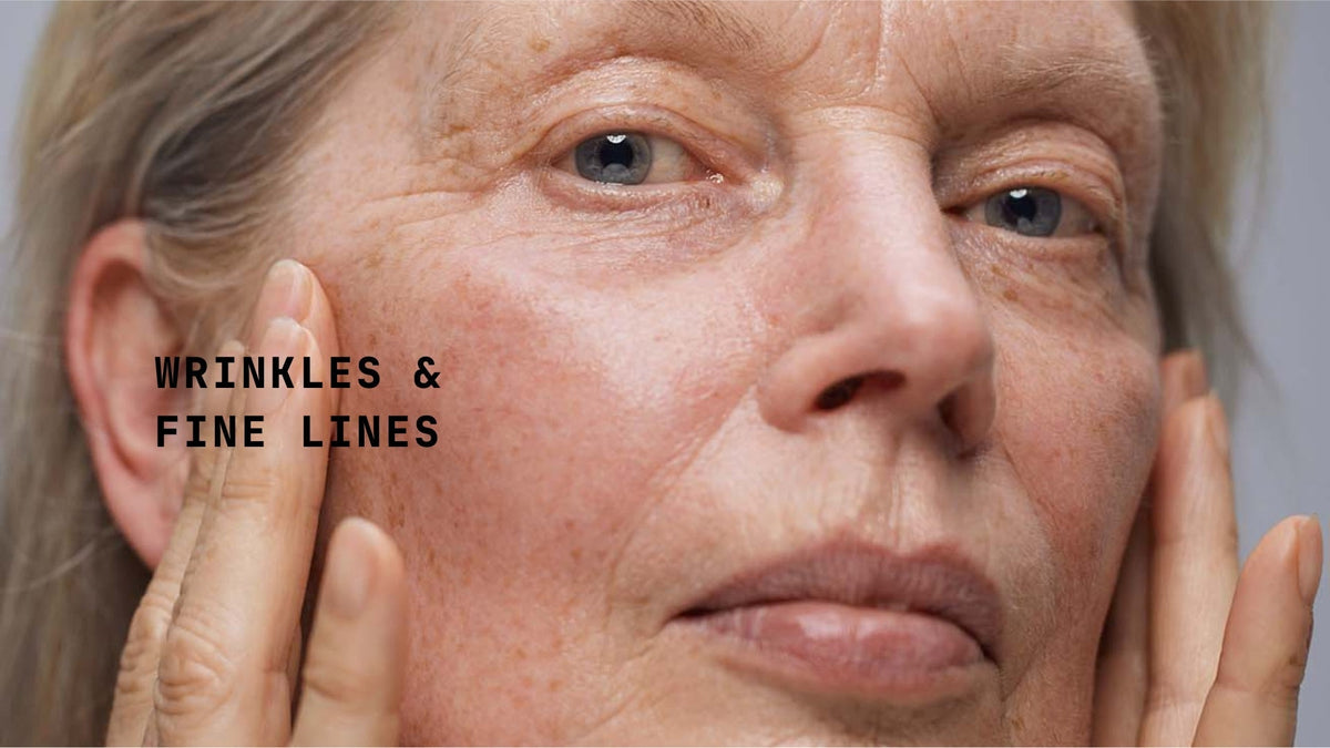 Vegan skincare for fine lines and wrinkles at TYPEYOURSKIN (Cyprus)